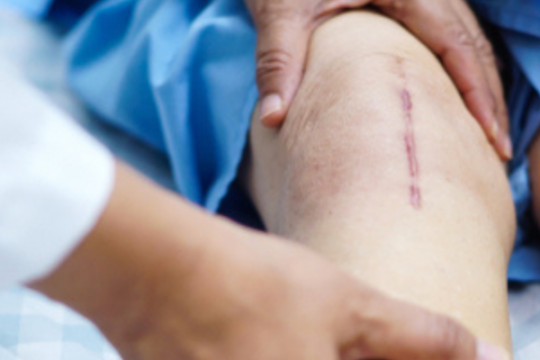 How to care for your scar after stitching? Here's the best tips!