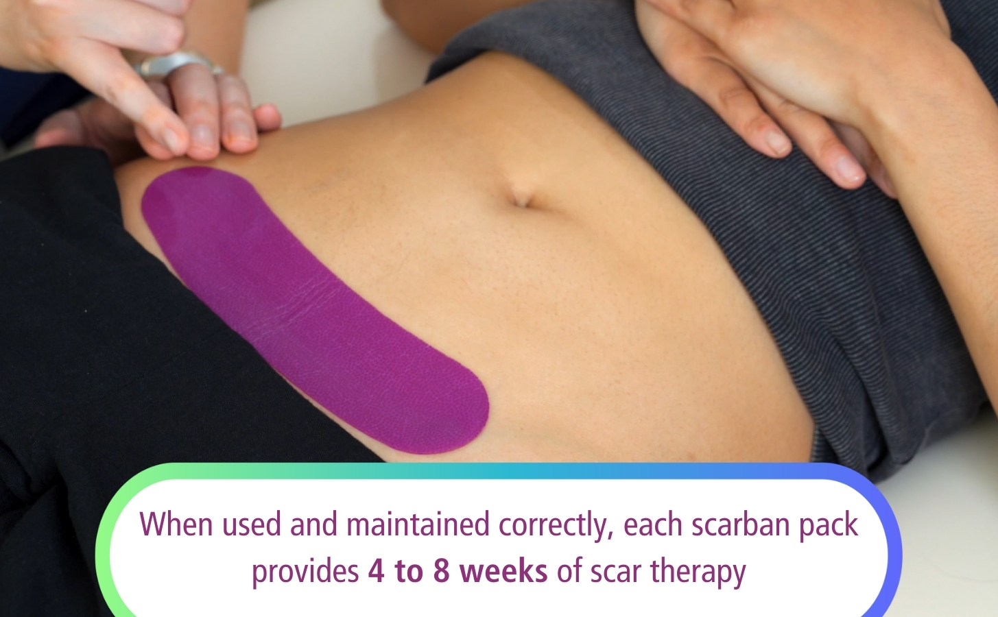 A close-up of a person’s abdomen shows a purple scarban silicone sheet applied to a scar. Text states each Scarban pack provides 4 to 8 weeks of scar therapy when used correctly.